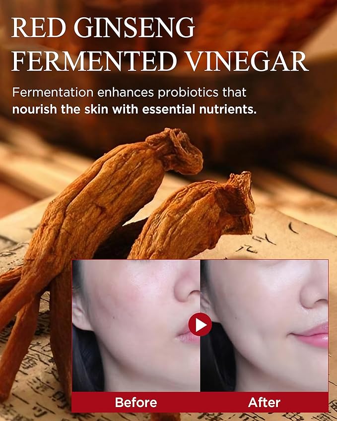 Bonyongo Red Ginseng Vinegar Emulsion – Lightweight Milky Face Lotion for Dry Skin – Fermented pH Balance with Adenosine, Hydrating and Firming Face Lotion, 5.07 fl oz