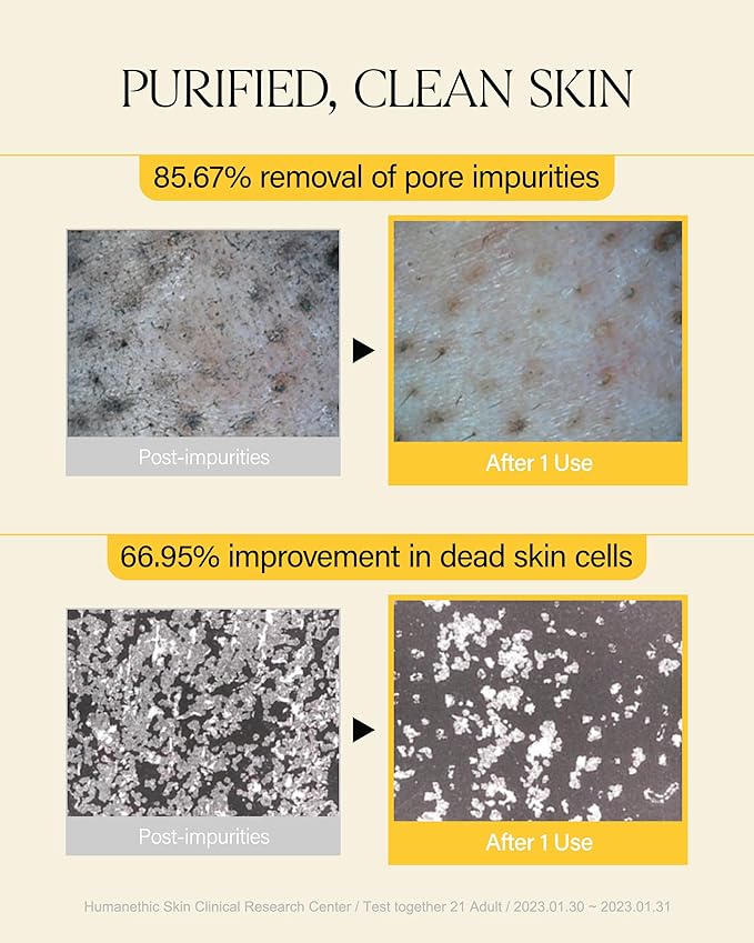 ABOUT ME Rice Makgeolli Skin Softener + About Me Rice Makgeolli Cleansing Oil Bundle