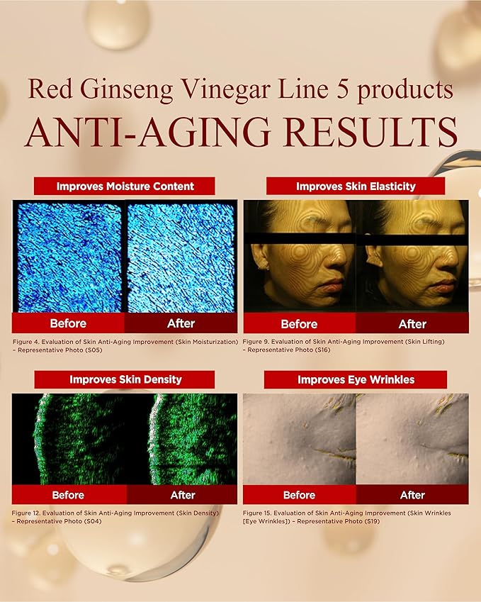 Bonyongo Red Ginseng Vinegar Emulsion – Lightweight Milky Face Lotion for Dry Skin – Fermented pH Balance with Adenosine, Hydrating and Firming Face Lotion, 5.07 fl oz