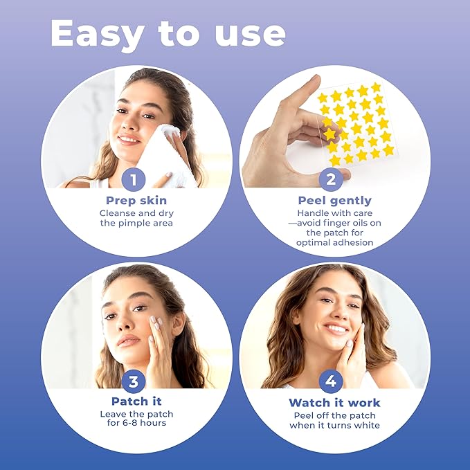 Star Pimple Patches for Face (240 Patches) with Hydrocolloid Only, Cute Acne Patches, Star Patches for Teens and Adults