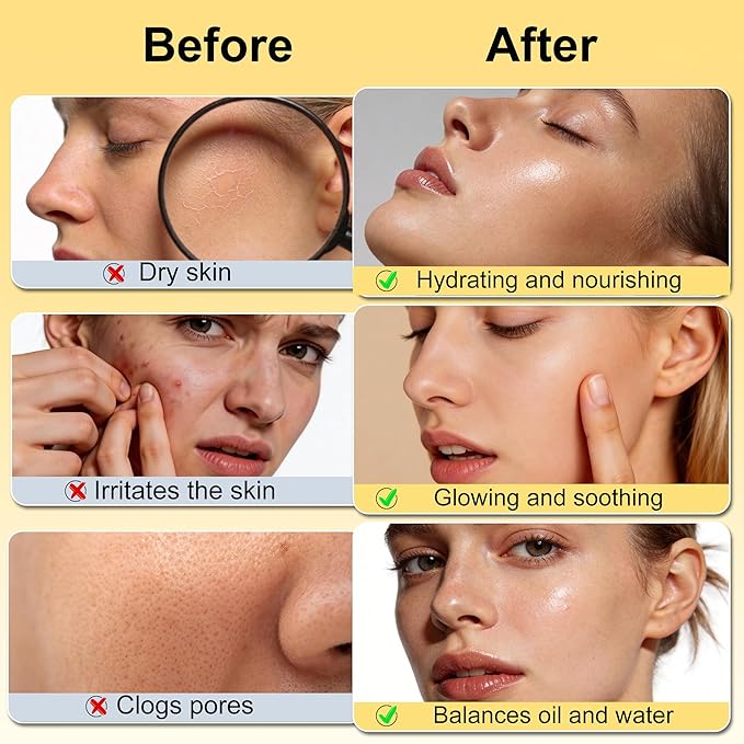 Skin Care Set,6Pcs Women Teen Glass Skincare w/Korean Rice Extract,Hydrate Glow Repair Anti-Aging Facial Routine Kit Self Care Gifts for Women Mom Wife Teenage Girl Her Valentines Day Christmas Gifts