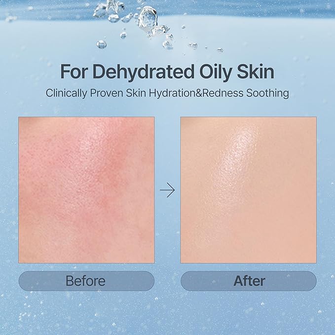 Witch Hazel Hyaluronic Toner Pad, Witch Hazel, Hyaluronic Acid, pH 5.5, 60 Pads