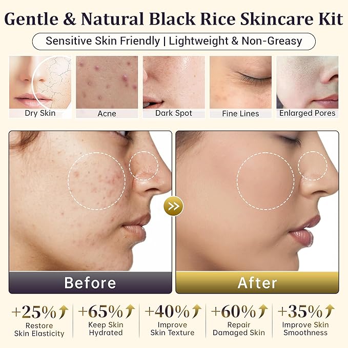 Natural Black Rice Skin Care Routine Set For Women, Anti Aging Face Kit With Face Wash, Toner, Serum, Body Lotion, Cream, Eye Cream, 6 PCS Skin Care Gift Set For All Skin Types, Acne, Fine Lines