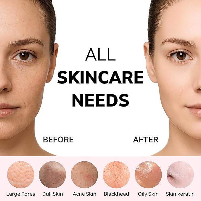 Wave Facial Sonic Cleanser | Deep Cleansing, Pore & Blackhead Care, 3 Modes, Replacable Head, 40,000 Cavitation Micro Vibrations, Waterproof Level IPX8, C-Type Charge, Korean Skincare (Gray)