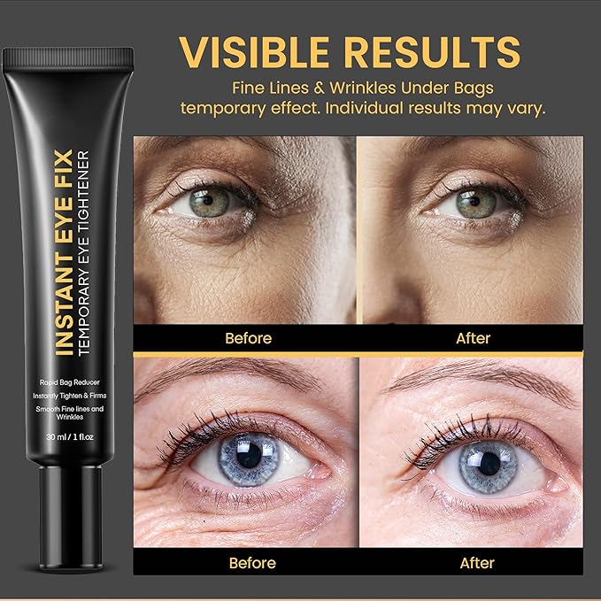 Temporary Instant Eye Tightener Cream: Instant Reduces Under-Eye Bags, Dark Circles Puffiness, Anti Aging Fine Lines, Firm Under Your Eyes