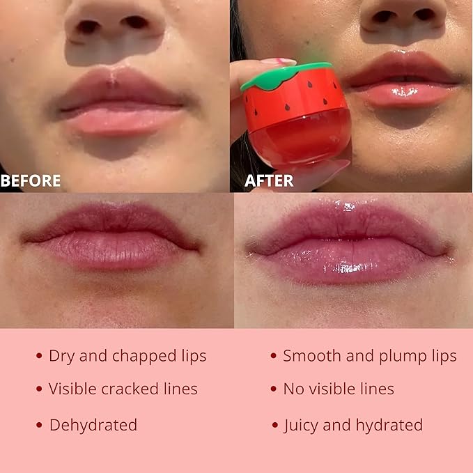 Original My Bee Balm Lip Balm – Watermelon Hydrating Balm – Honey Pot for Dry, Chapped & Cracked Lips – Deeply Moisturizes & Hydrates Lips with Organic Beeswax & Vitamin E