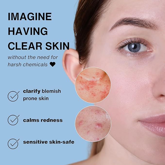Hypochlorous Acid Spray – 3.4oz Travel Size HOCl Facial Mist & Daily Cleanser for Sensitive Skin | Clarifying & Calming Toner for Redness, Irritation & Breakout-Prone Skin