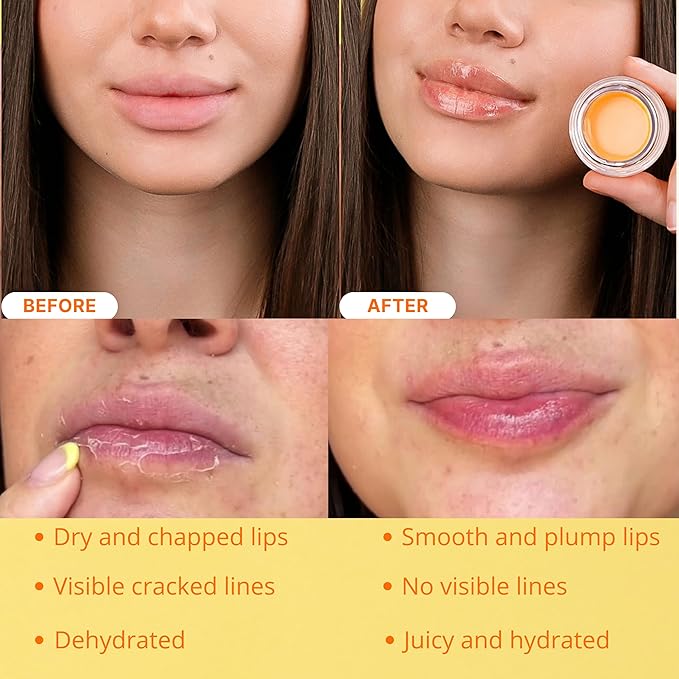 Original Bee Balm Lip Balm – Peach Hydrating Lip Butter with Propolis & Honey, Lip Moisturizing Mask for Dry & Cracked Lips, Reduces Lip Lines with Beeswax & Vitamin E