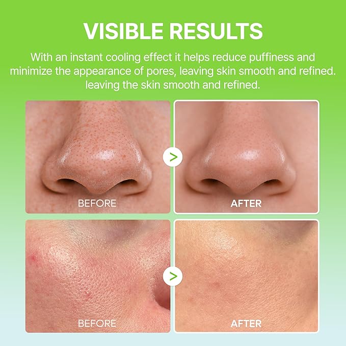 Dr.Melaxin Cactox Pore Relief Multi Balm Stick – Cooling & De-Puffing, Pore Tightening, Reduces Puffy Skin & Enlarged Pores, Instant Cooling Skin care Balm