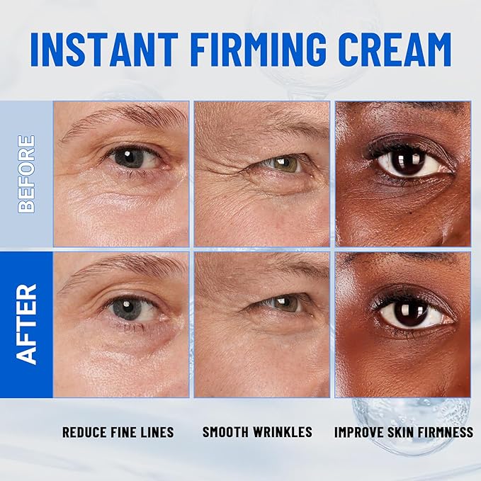 iMethod Perfection Eye Tightener - Temporary Eye Tightener Cream, Under Eye Cream Reduces Dark Circles & Puffiness, Instant Firming Formula for Fine Lines & Wrinkles, 20ml