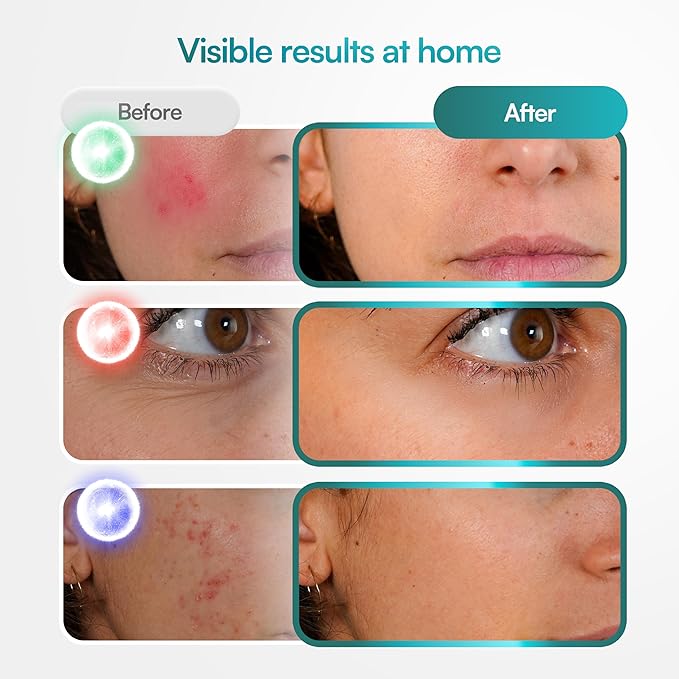Red Light Therapy for Face, Wireless LED Face Mask Light Therapy, 9 Modes, 850nm NIR & 630nm Red, 2500mAh Rechargeable, 3D Facial Fit, At-Home Skin Care