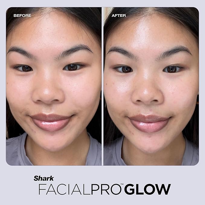 Shark FacialPro Glow at-Home Hydro-Powered Facial System with DePuffi Hot & Cold Therapy – Professional Spa Skincare Device for Pore Cleansing, Hydration, & Radiant Glow, Lilac, FH320PL
