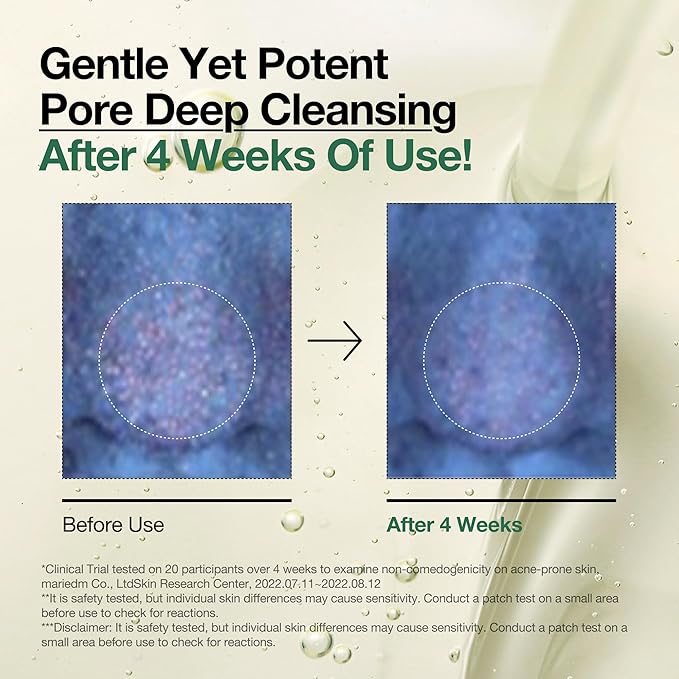 Auna Deep Pore Treatment Duo Heartleaf Pore Control Cleansing Oil, Heartleaf 77 Toner Pad, Exfoliating Facial Pads, After-Cleansing for Gentle Facial Care, Korean Skincare Set