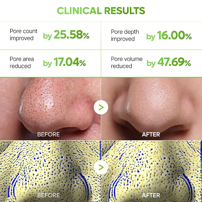 Dr.Melaxin CACTOX 3-STEP NOSE MASK PACK with AHA & PHA for Sebum Softening Pore Tightening Skin Repair 3-Step Nose Pore Pack