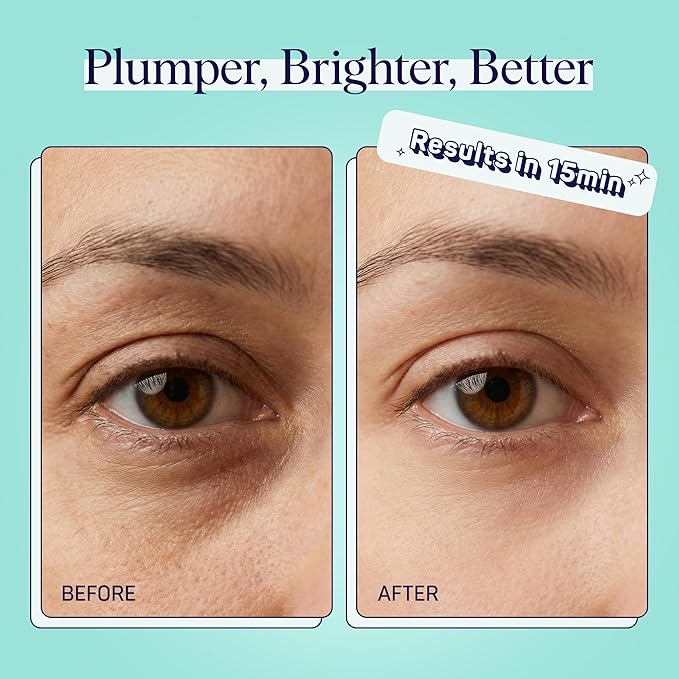 SpaLife Cooling Cucumber Eye Pads | Korean Dark Circles & Puffy Eyes Treatment | Nourishing Cucumber Eye Pads | Eye Mask for Puffy Eyes Daily Depuffing Eye Patches | 4 Packs of 12