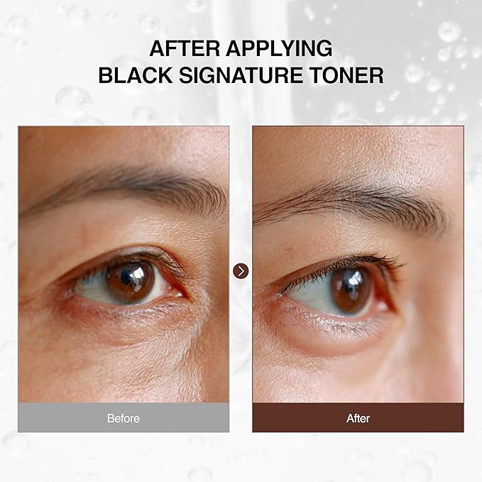 Ottie Black Signature Toner with 60% Snail 5.07 fl.oz, Hydrating Facial Toner for Face, Korean Skin Care Toner for Sensitive Skin, Lightweight Daily for Smooth Skin Texture