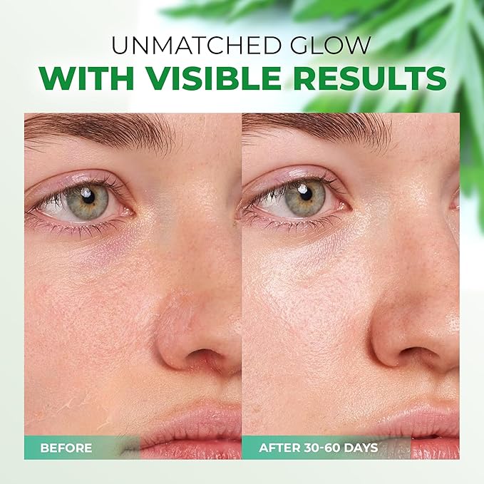 Mugwort Essence,Hydrating Face Toner with Artemisia, Hyaluronic Acid, Centella Asiatica & Rosemary Extract - Deep Moisturizing Skin Care & Barrier Protection Face Mist - 150 ml