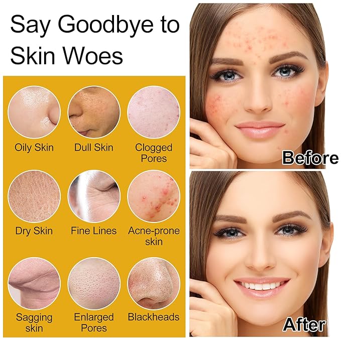 Skin Care Set,5Pcs Women Teen Glass Skincare w/Korean Rice Extract,Hydrate Glow Repair Anti-Aging Facial Routine Mini Kit Self Care Gifts for Women Mom Wife Teens Teenage Girl Airplane-Friendly Sizes