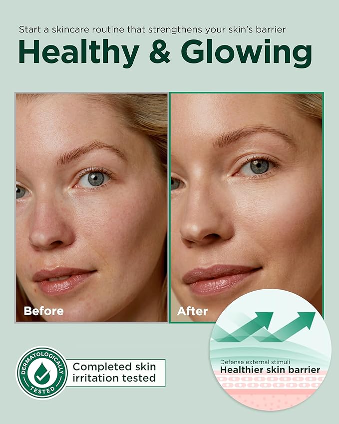 EASYDEW Barrier Repair Toner - PHA Face Toner for Smooth, Moisturized Skin - Ideal for Dry and Irritated Skin, 6.76 fl.oz
