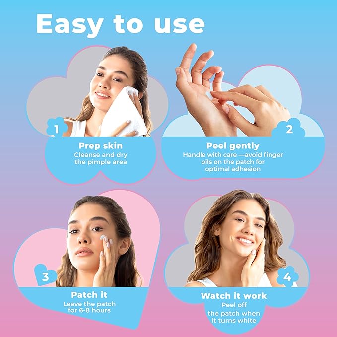 Pimple Patches for Face Cute (Hearts, Clouds Pink and Blue), Zit Patches Star Sticker 240 pack
