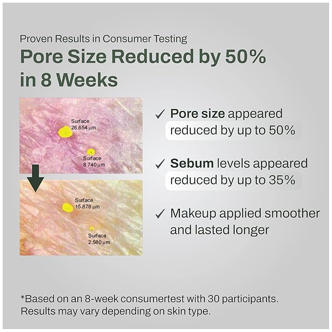 Pore Control Gel to Foam Cleanser, Deep Pore Cleansing Face Wash, Non Drying Lightweight, Soft Foam for Smooth Clear Skin, Korean Facial Cleanser with Green Tea & Niacinamide, 155ml/5.24 fl oz