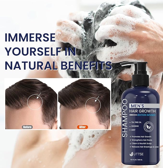 Biotion Hair Growth Shampoo for Men: Natural Thickening Shampoo with Tea Tree Oil Ginseng Mint for Hair Loss and Thinning Hair - 10.1 fl.oz, Dark Blue