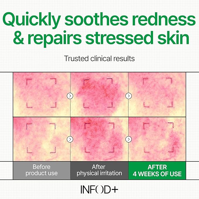 INFODPLUS Korean Skin Care Sensitive Face Cream, Lightweight Moisturizer with Ceramides & Panthenol, Skin Barrier Support & Deep Hydration, Low pH Daily Cream for AM/PM Use, 50ml