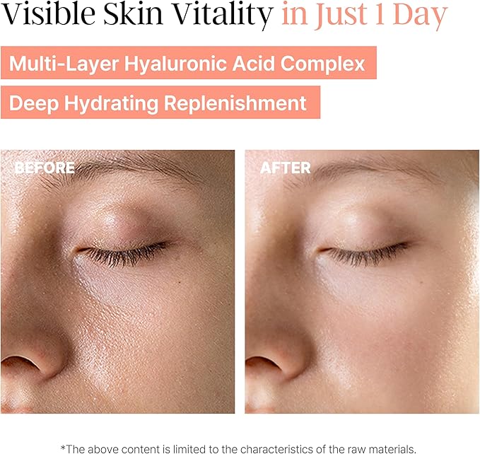 Peach Skincare Set, PDRN Peach Toner & EGF Peach Serum, 2-Step Korean Skin Care Routine for Radiant & Even-Looking Skin