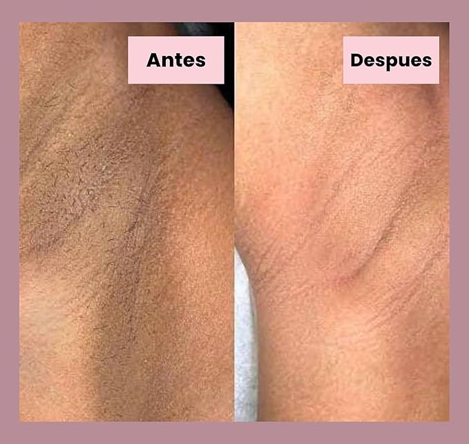 Generic Tonico Despigmentante LB *Elimina pecas, barros, paños, melasma*