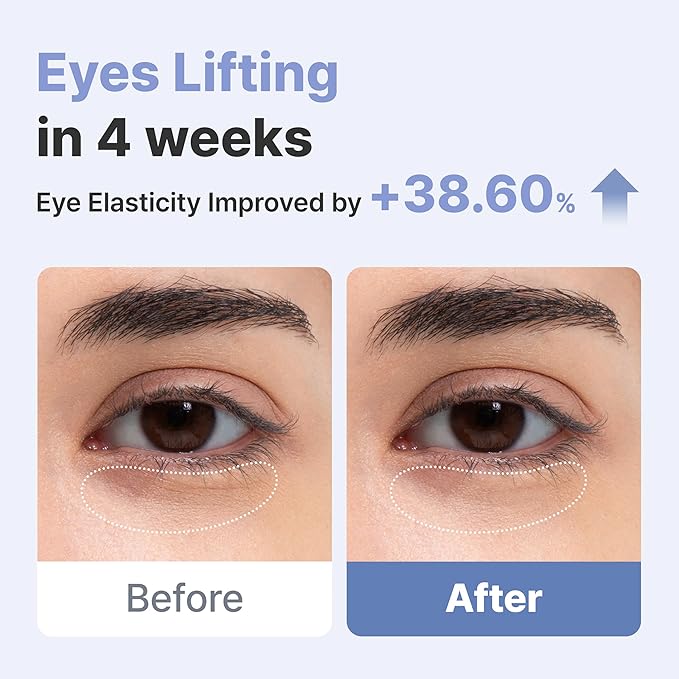 AROCELL Wrinkle Solution Eye Cream 0.5 fl oz – Korean Under Eye Cream with Collagen & Galvanic Care, Hydrating Moisturizing Eye Moisturizer, Elasticity Boosting, Gentle Non Sticky Daily Eye Care