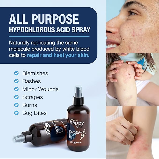 Happy Skin Hypochlorous Acid Spray for Face Travel Size – Extra Strength Natural Full Body Cleansing Toner for Acne – Soothe, Hydrate & Repair Dry, Sensitive Skin – pH Balanced, Non-Toxic 2oz