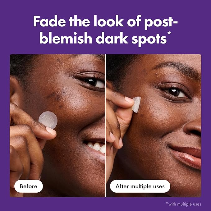 Hero Cosmetics Mighty Patch Micropoint™ for Dark Spots - Post-Blemish Dark Spot Patch with 395 Micropoints, Dermatologist Tested and Non-irritating (8 Count)