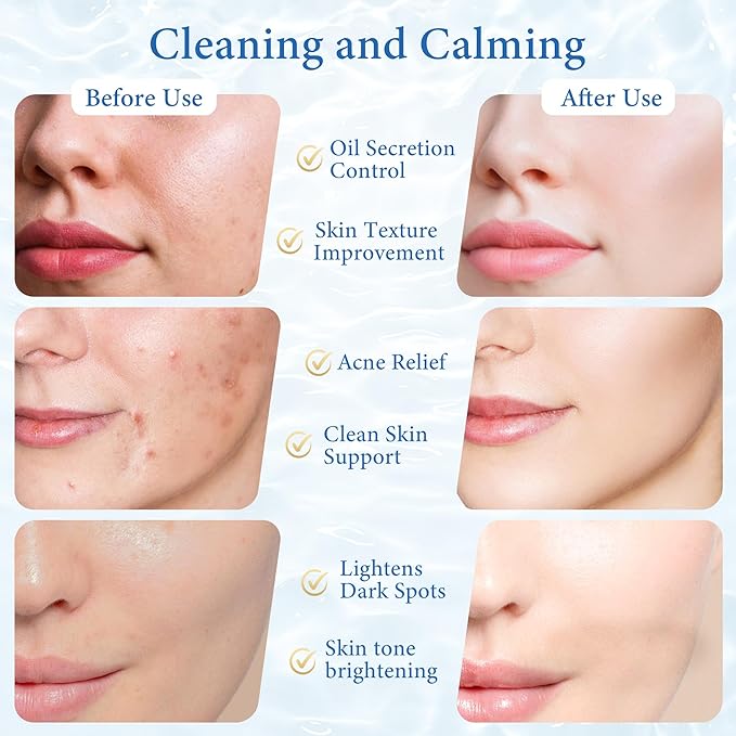 1% Salicylic Acid Pads for Face & Body – Exfoliating Toner Pads with Centella Asiatica, Hyaluronic Acid & Probiotics – Gentle Pore Clearing, Blackhead Removal, Skin Texture Refinement – 70 Count