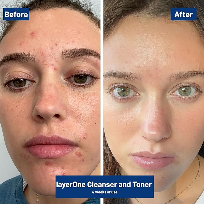 layerOne Clarifying Enzyme Toner – Soothes, Hydrates & Refines Skin, Preps for Skincare Routine, 3.38 fl oz