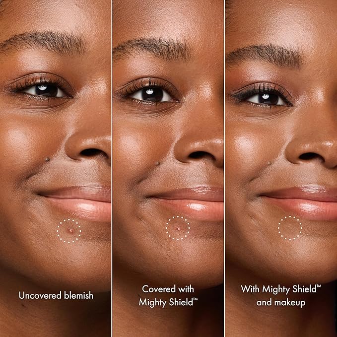 HERO COSMETICS Mighty Shield™ Liquid Patch Invisible Blemish Protectant for Pimples, Zits, and Blemish Wounds. Fast-Drying and Protects Blemishes from Makeup, Sunscreen