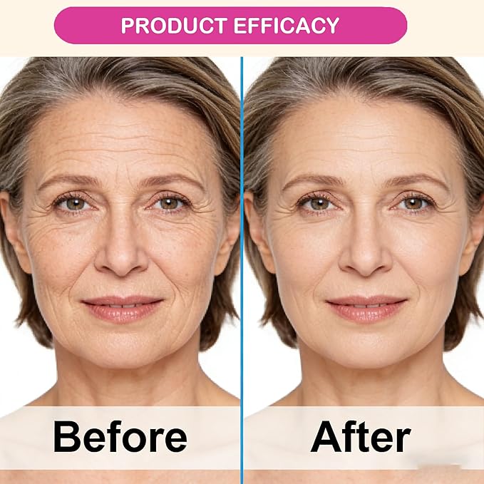 Eye Care Duo Calcium Multi Balm Stick + Hydrogel Under Eye Patches 30 Pairs, Anti-Aging, Wrinkle Reducing, Hydrating & Firming, Volume Balm for Eyes, Neck & Face, Travel-Friendly