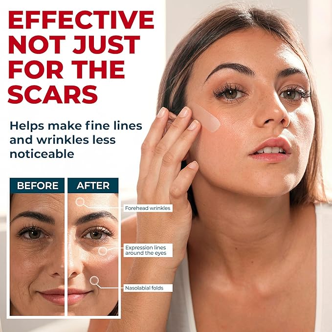 Medical Grade Silicone Scar Tape - Transparent (1.6”x150”) - Visible Difference on Surgical & Keloid Scars - Reusable Silicone Scar Sheets - Easy to Use Silicone Tape for Scars