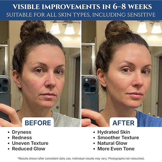 Copper Peptides Serum for Face, 2% Copper Peptide with 4% Epidermal Growth Factor (EGF Serum), Niacinamide, Ceramides, Squalane & Hyaluronic Acid, Multi Peptide, Collagen Peptide Complex, 1 fl oz