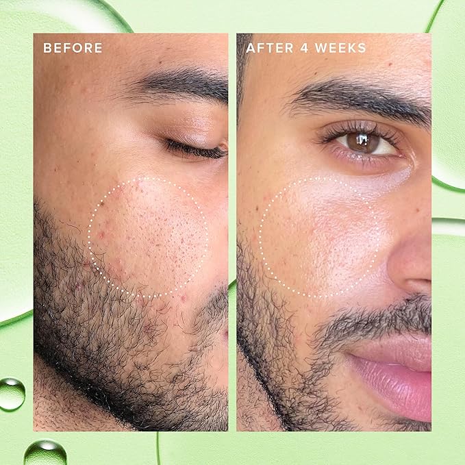 Farmacy 2% Salicylic Acid Toner for Face - Deep Sweep BHA Liquid Exfoliant + Pore Cleaner - Controls Oil, Gently Exfoliates + Refines Pores - Skin Care for Combo, Oily + Blemish-Prone Skin - (120ml)