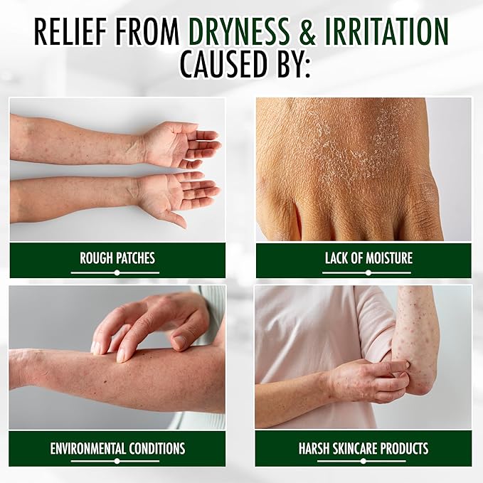 GLY MIRACLE Unscented Travel Lotion Tubes (3 Pack, 0.5 oz Each) – Non-Greasy Skin Moisturizer for Normal to Dry Skin, Deep Hydration for Hands, Body & Feet