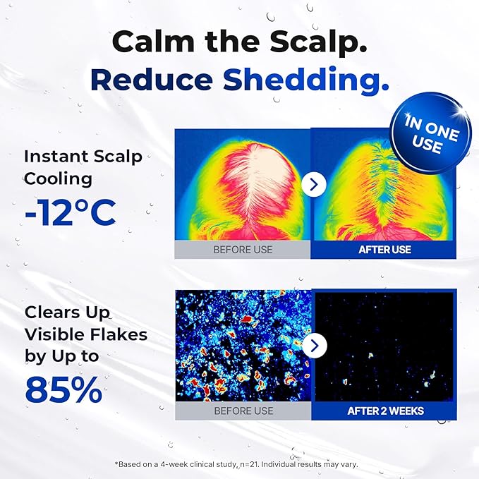 EPAIS Scalp Boosting Serum 150ml, Comb Applicator Scalp Ampoule with 38 Brush Tips, Clinically Tested Dandruff & Flake Reduction, Biome PDRN Exosome, Korean Hair Care (5.07 fl.oz)