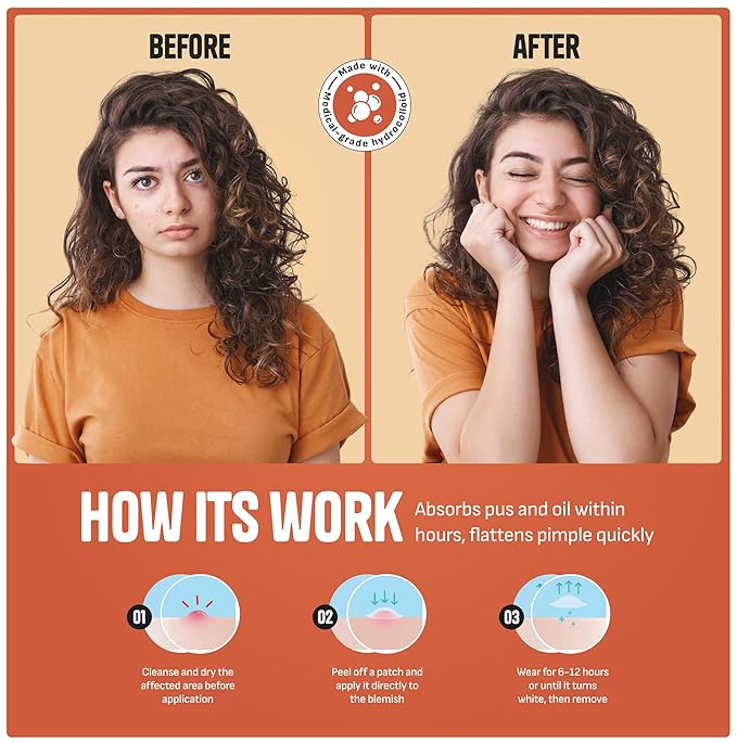 Pimple Patches for Face – Day & Night Acne Patches for Fast Healing, Skin Clarity – Invisible Hydrocolloid Patches, Waterproof Spot Treatment – All Skin Types Zit Patches of 60/120/180