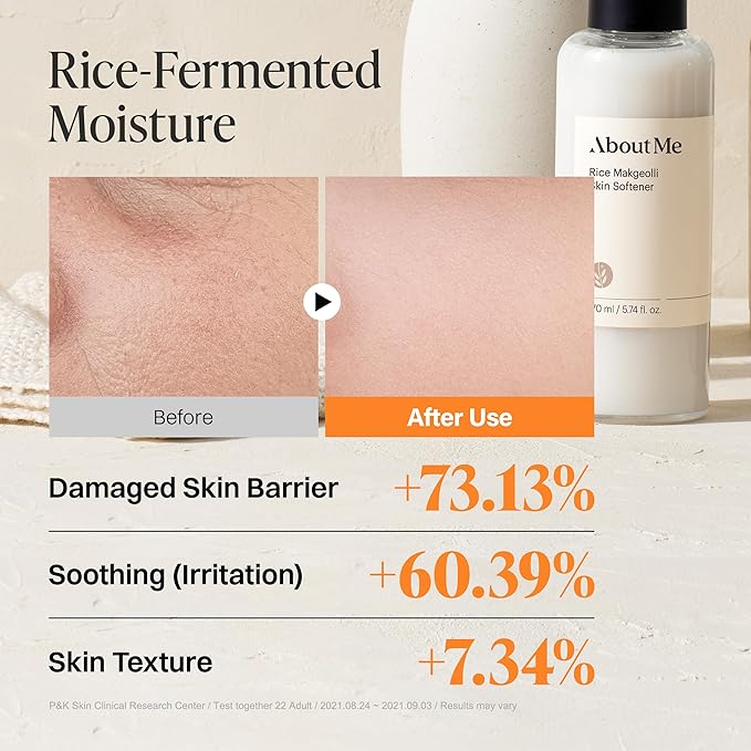 About Me Rice Makgeolli Skin Softener – Triple Ferment Milky Toner with 5 Ceramides & Galactomyces, Hydrating Essence Toner for Glass Skin, Fragrance-Free for Dry Sensitive Skin, 5.74 fl oz