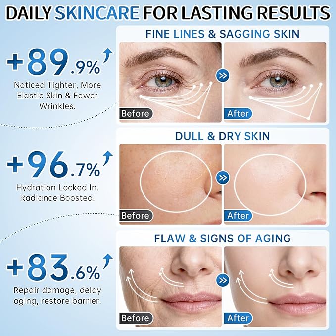 Collagen Skincare Set for Women – 7Pcs Face Care Kit with Cleanser,Toner,Serum,Eye Cream,Face Cream & Masks – Hydrating,Firming & Nourishing Routine,Gentle for All Skin Types,Great Gift Idea