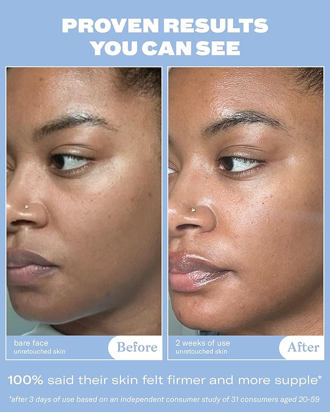 Then I Met You Renewing Rich Beauty Cream, Deep Hydration Korean Moisturizer with Quad Ginseng Complex, Fast Absorbing Vegan-Cruelty-Free Plant-Based Antioxidant, Alcohol Free Skincare for Exfoliated