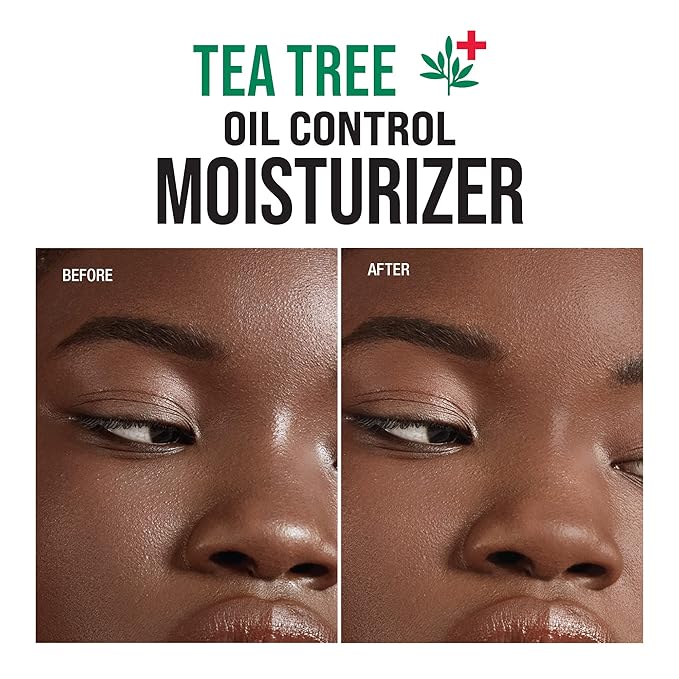 KISS NEW YORK Face Moisturizer Tea Tree Oil Control Anti-Shine Facial Moisturizer, Korean Skin Care For Normal to Oily Skin, Lightweight Formula 3.38 Fl Oz (1 PACK)