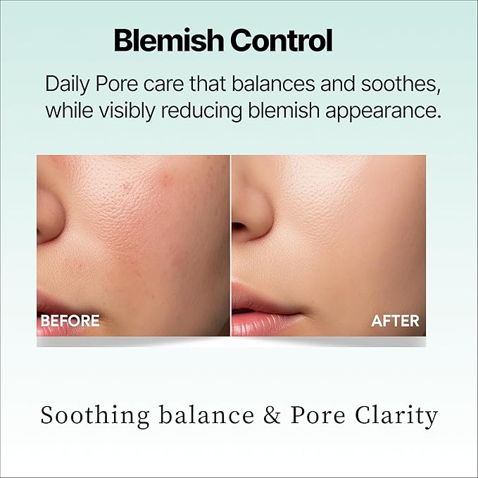 A'demang Bergamot Pore Clearing Toner Pad | Exfoliating Facial Pad, Facial Peels, Hydrating | for Acne Prone, Dry Oily Combination Skin | Korean Skincare [9.4 fl oz. / 280ml, 60 Pads]