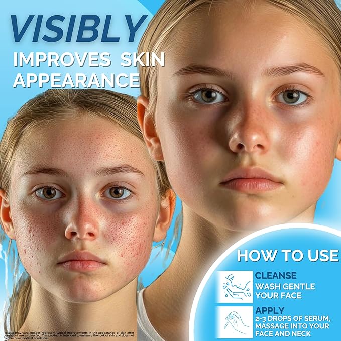 ERASE Clear Skin 3-Step System | Spotless Serum + Pro-Collagen Hydrating Mask + Acne Patches | Brighten, Hydrate & Clear Skin | Niacinamide, Vitamin C & Collagen | For Teens & Adults