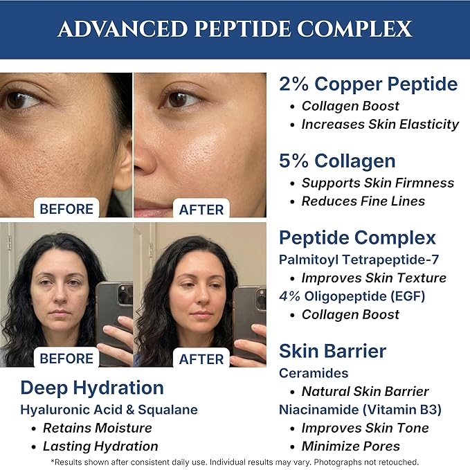 Copper Peptides Serum for Face, 2% Copper Peptide with 4% Epidermal Growth Factor (EGF Serum), Niacinamide, Ceramides, Squalane & Hyaluronic Acid, Multi Peptide, Collagen Peptide Complex, 1 fl oz