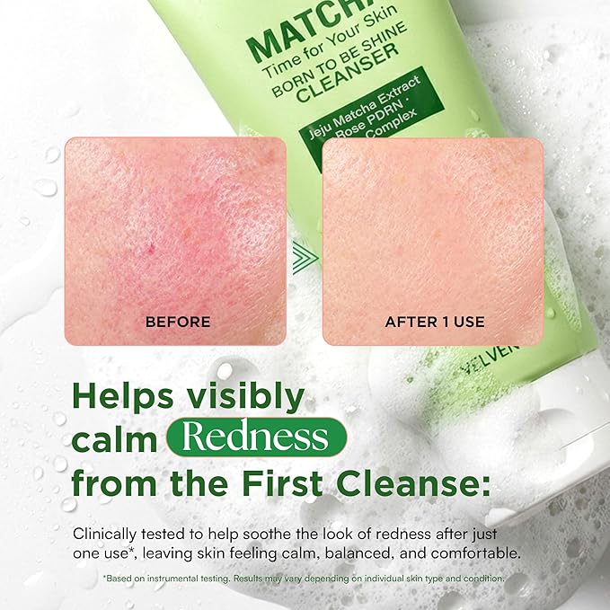 Matcha 3-Step Skincare Set – Cleansing Foam, Toner Pad & Moisturizing Cream – Green Tea & Plant PDRN – Hydrating, Soothing & Antioxidant Korean Skincare Routine